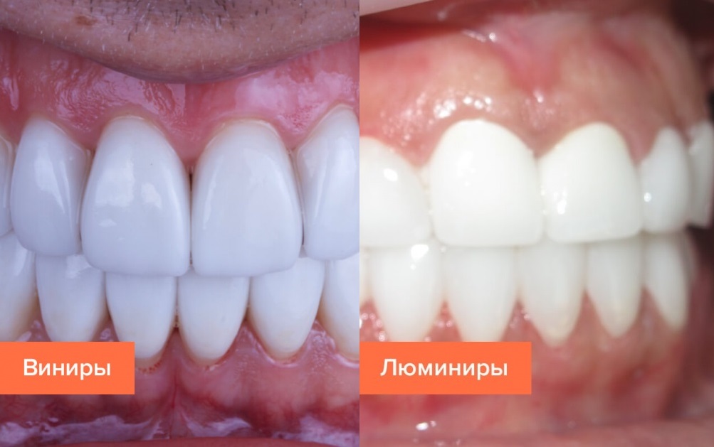 Люминиры2.jpg