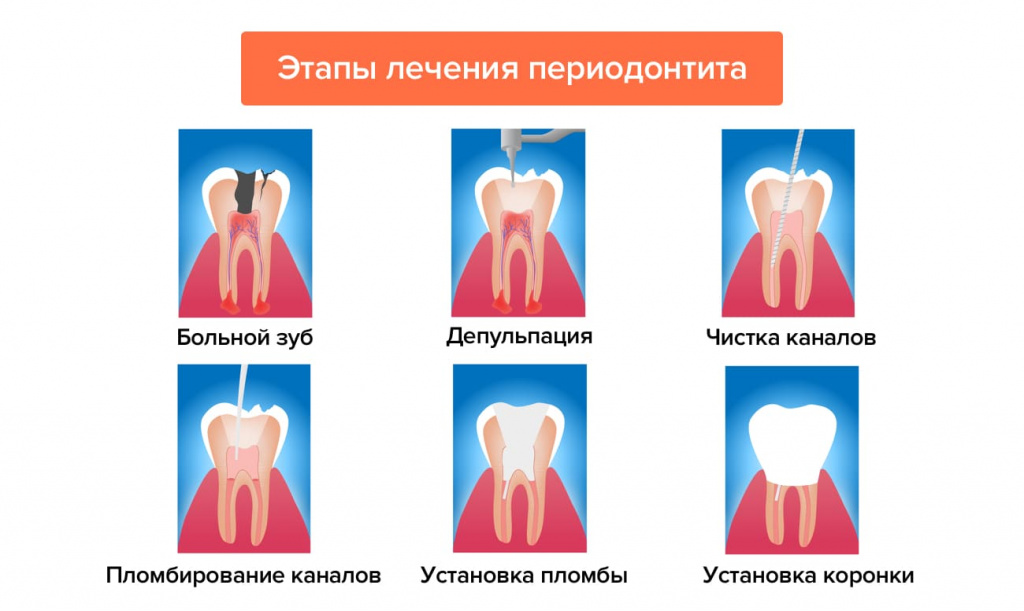 62f14e121bc1c161d390a1e49708cdf8.jpg 62f14e121bc1c161d390a1e49708cdf8.jpg