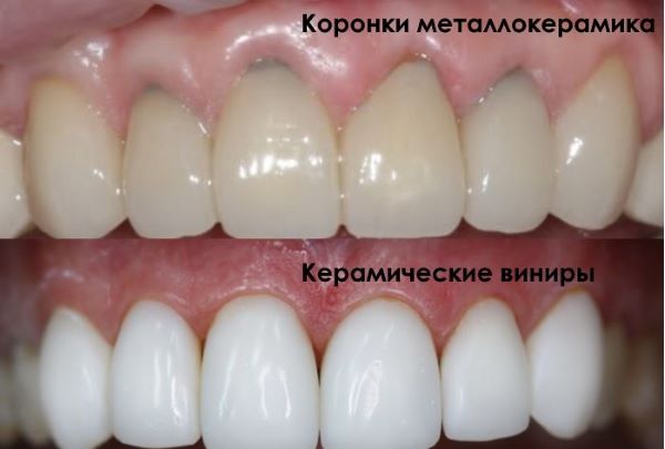 8ff45395645cad2590e088d44c801fc7.jpg